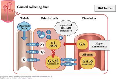 Clinical Risk Factors of Licorice-Induced Pseudoaldosteronism Based on Glycyrrhizin-Metabolite Concentrations: A Narrative Review